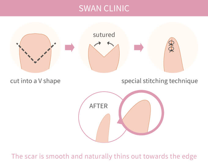 Swan Clinic's Approach