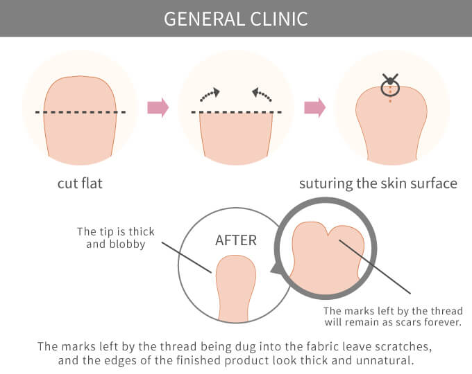 Typical Approach at Other Clinics