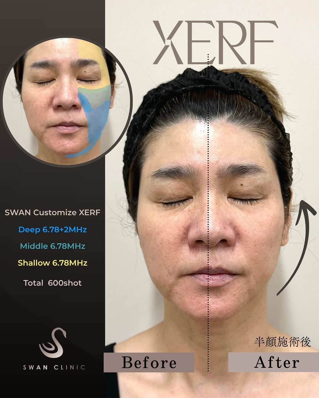 しっかり上げてすっきり落とす